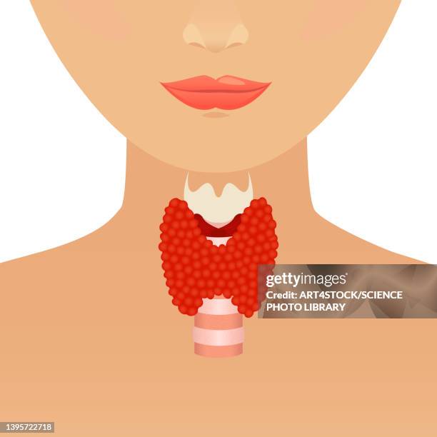 thyroid in women, conceptual illustration - thyroid gland stock-grafiken, -clipart, -cartoons und -symbole