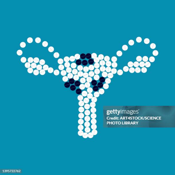 uterine fibroids, conceptual illustration - menopause stock illustrations