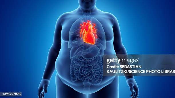 obese man's heart, illustration - oberkörper stock-grafiken, -clipart, -cartoons und -symbole