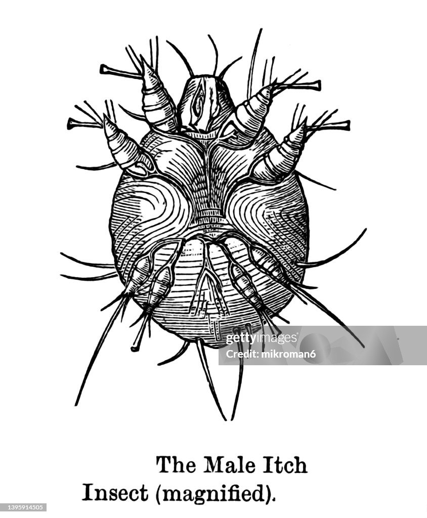 Mitch Insect Old Engraved Illustration Of Male Itch Mite Insect High-Res Stock Photo ...