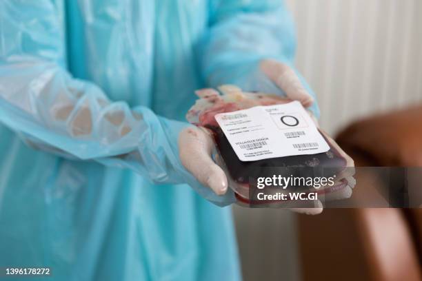 close up of blood bags on hand - groupe sanguin photos et images de collection