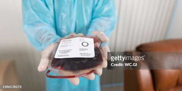 close up of blood bags on hand - blood bag stock-fotos und bilder