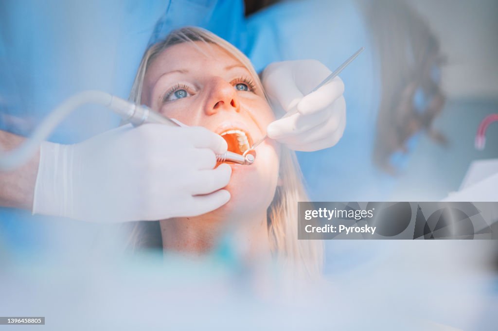 Nahaufnahme eines zahnärztlichen Drill-Verfahrens beim Zahnarzt