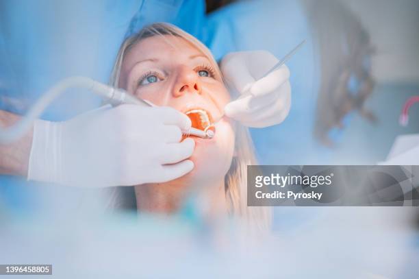 close-up of a dental drill procedure at dentist - dental hygienist stock pictures, royalty-free photos & images
