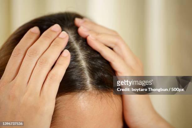 a woman has problems with hair and scalp - cheveux secs photos et images de collection
