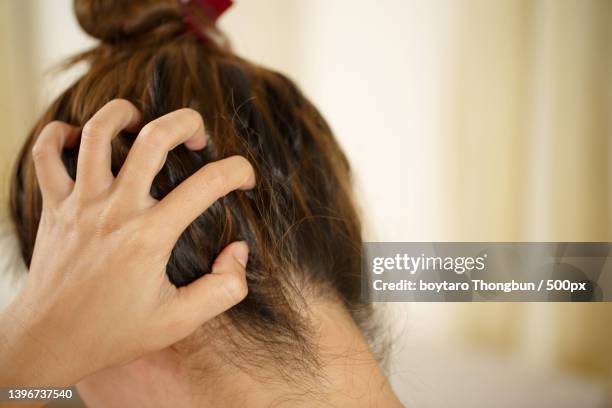 a woman has problems with hair and scalp - dry hair photos et images de collection