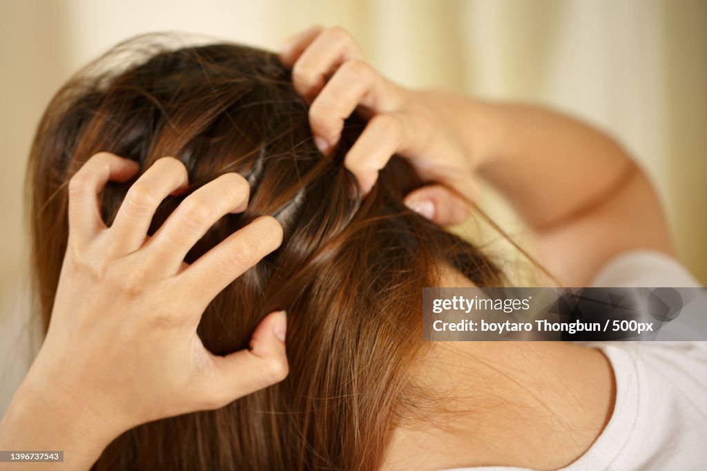A woman has problems with hair and scalp
