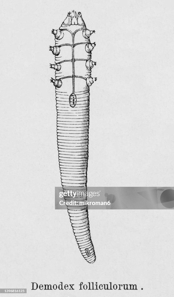 Old engraved illustration of microscopic mite (Demodex folliculorum)