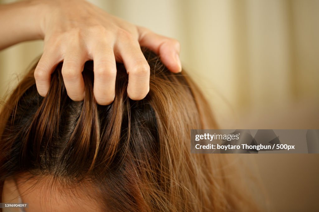 Cropped hands of woman with hands on hair with itchy scalp