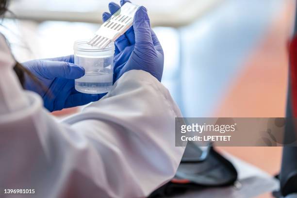 medical test - urine sample stock-fotos und bilder