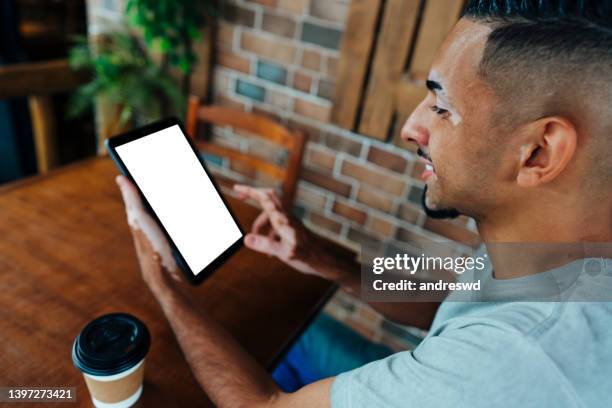 man with vitiligo using digital tablet - systemic lupus erythematosus stock pictures, royalty-free photos & images
