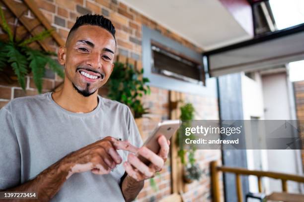 man with vitiligo using smartphone - systemic lupus erythematosus stock pictures, royalty-free photos & images
