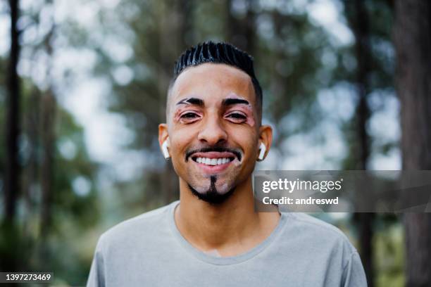 portrait of a man with vitiligo - systemic lupus erythematosus stock pictures, royalty-free photos & images