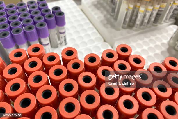 2,553 Testing Reagents Stock Photos, High-Res Pictures, and Images ...