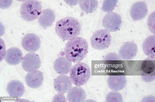 malaria. plasmodium vivax. many parasites inside red blood cells 500x - malaria stock-fotos und bilder