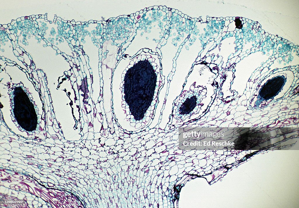 LIVERWORT, ANTHERIDIA , Marchantia sp., male gametophyte, 25X at 35mm.
