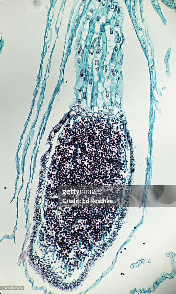 LIVERWORT, SPOROPHYTE, Marchantia, 25X at 35mm. Shows a single sporophyte, sporangium, and spores .