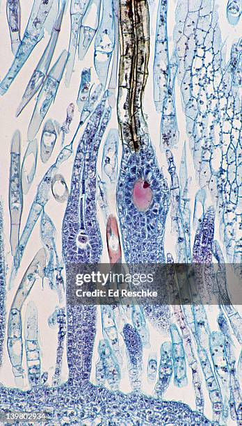 moss archegonia. zygote & unfertilized egg. archegonium on right has a zygote . the archegonium on left has an unfertilized egg . shows neck canal cells & disintegrating canal cells . 50x at 35mm - archegonia stock pictures, royalty-free photos & images