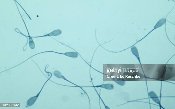 spermatozoa, bull, 250x.  shows the head and flagellum (or tail). - cell flagellum stock-fotos und bilder