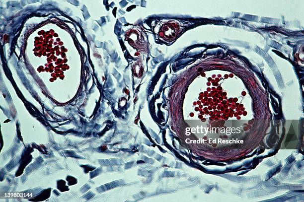 artery & vein and red blood cells. 3 layers in artery. 100x at 35mm - micrografía científica fotografías e imágenes de stock