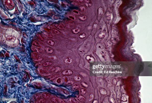 stratified squamous epithelium skin, epidermis, cornified (dead) layer, dermis (blue) 250x - lederhuid stockfoto's en -beelden