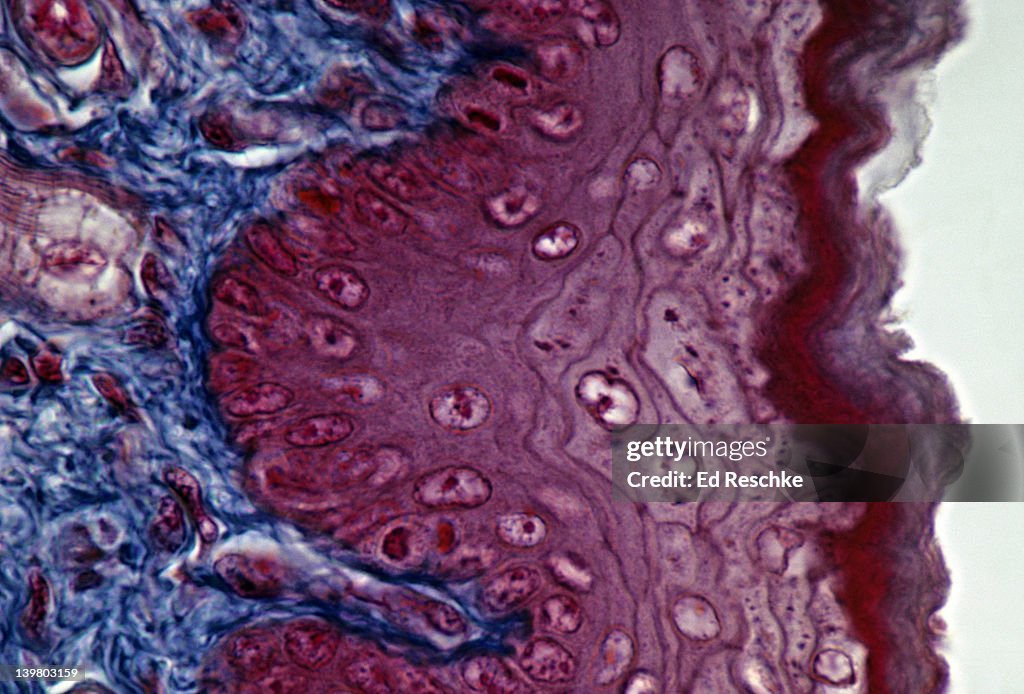 STRATIFIED SQUAMOUS EPITHELIUM SKIN, EPIDERMIS, CORNIFIED (DEAD) LAYER, DERMIS (BLUE) 250X