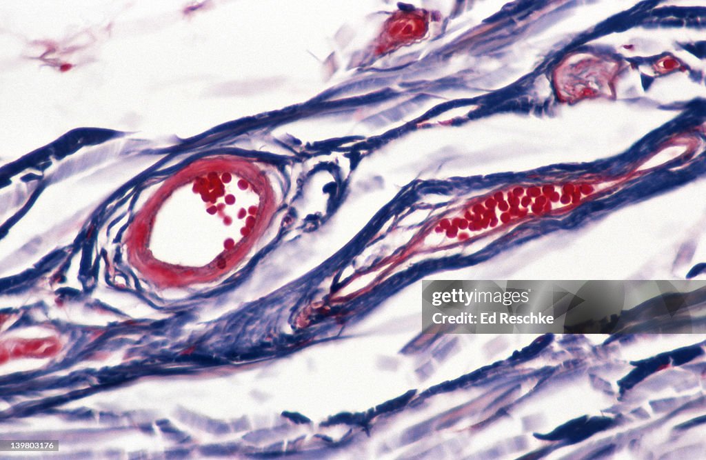 BLOOD VESSELS. SKIN; SUBCUTANEOUS LAYER, VENULES (RIGHT), ARTERIOLE (LEFT), RED BLOOD CELLS. 100X at 35mm