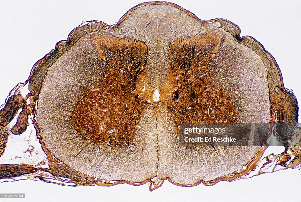 SPINAL CORD, CROSS-SECTION. SHOWS MOTOR NEURON, DORSAL AND VENTRAL HORNS. 5X