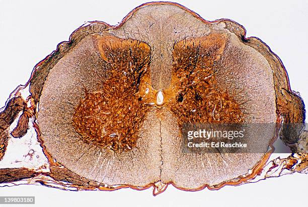 spinal cord, cross-section. shows motor neuron, dorsal and ventral horns. 5x  - spinal cord cross section stock pictures, royalty-free photos & images