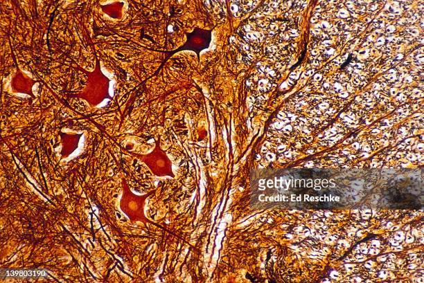 spinal cord, shows: neurons, grey matter with motor neuron cell bodies, white matter with myelinated nerve fibers. 50x - spinal neuron imagens e fotografias de stock