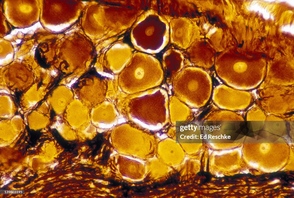 Ganglion (dorsal root or spinal ganglion neurons). Shows mass of sensory neuron cell bodies; 100x. Cell bodies show nuclei and nucleoli