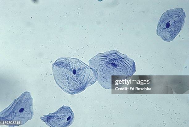 epithelial (cheek) cells. oral cavity, methylene blue stain. shaus nuclei, 100x cytoplasm & cell membrane - light micrograph stock pictures, royalty-free photos & images