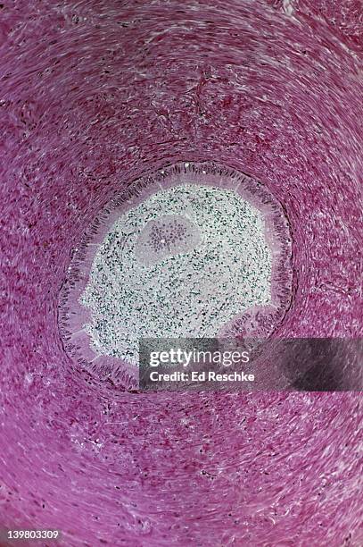 ductus deferens (or vas deferens). cross section, 25x at 35mm. shows a cross section of the ductus deferens, abundant smooth muscle in the wall, pseudostratified ciliated columnar epithelium, and spermatozoa in the lumen. - mehrreihige epithel stock-fotos und bilder