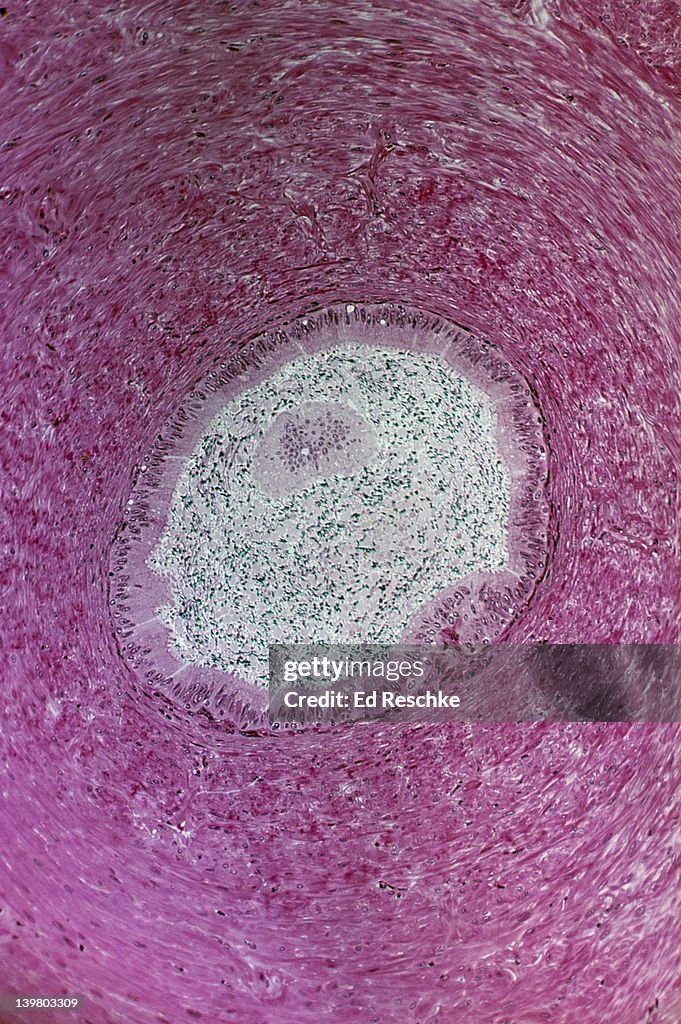 DUCTUS DEFERENS (or VAS DEFERENS). Cross section, 25X at 35mm. Shows a cross section of the ductus deferens, abundant smooth muscle in the wall, pseudostratified ciliated columnar epithelium, and spermatozoa in the lumen.