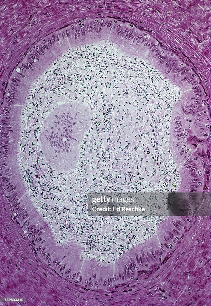 DUCTUS DEFERENS (or VAS DEFERENS). Cross section, 50X at 35mm. Shows: the ductus deferens lined with pseudostratified ciliated columnar, epithelium, spermatozoa in the lumen, and smooth muscle in the wall.