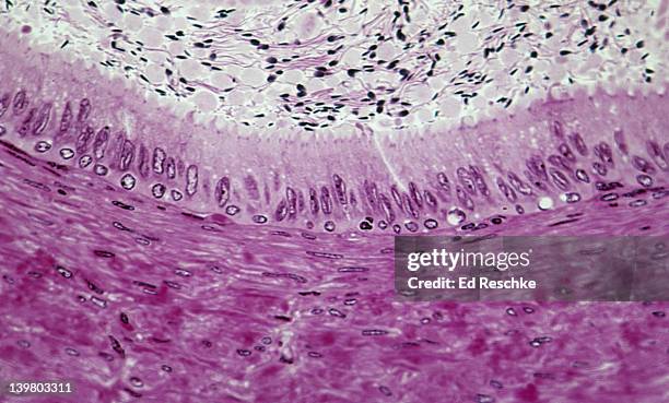 ductus deferens (or vas deferens). cross section, 100x at 35mm. shows: the pseudostratified ciliated epithelium lining the ductus deferens, smooth muscle in the wall (peristaltic waves propel the sperm), and spermatozoa in the lumen. - mehrreihige epithel stock-fotos und bilder