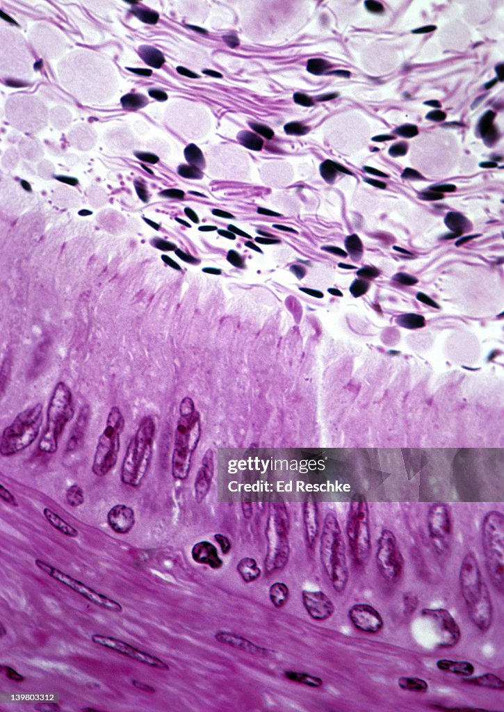 DUCTUS DEFERENS (or VAS DEFERENS). 250X at 35mm. Shows: the pseudostratified ciliated columnar epithelium, spermatozoa in the lumen of the vas, and smooth muscle in the wall (propels the sperm with peristaltic waves).
