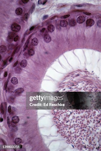 EPIDIDYMIS. PSEUDOSTRATIFIED COLUMNAR EPITHELIUM WITH STEREOCILIA, 250X at 35mm. Shows: epithelium with stereocilia and the lumen with spermatozoa. Sperm are temporaily stored in the epididymis. EPIDIDYMIS. PSEUDOSTRATIFIED COLUMNAR EPITHELIUM WITH STEREOCILIA, 250X at 35mm. Shows: epithelium with stereocilia and the lumen with spermatozoa. Sperm are temporaily stored in the epididymis.