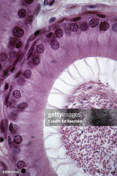 epididymis. pseudostratified columnar epithelium with stereocilia, 250x at 35mm. shows: epithelium with stereocilia and the lumen with spermatozoa. sperm are temporaily stored in the epididymis. - microscopie optique photos et images de collection