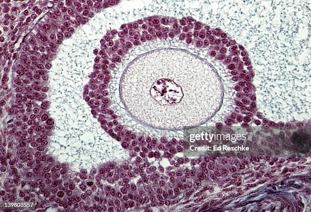 ovarian follicle with an oocyte (egg), 100x. shows: a follicle, oocyte (egg) with a zona pellucida, follicular cells (secrete hormones), germ hill (cumulus oophorus), and antrum. the cells surrounding the egg are considered stratified cuboidal epithelium. - cuboidal epithelium stock pictures, royalty-free photos & images