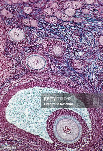 ovary. developing follicle, primary follicles, primordial follicles, 50x.  also shows: stroma, oocytes (eggs), antrum, follicular cells, and the zona pellucida. - human egg cell stock pictures, royalty-free photos & images