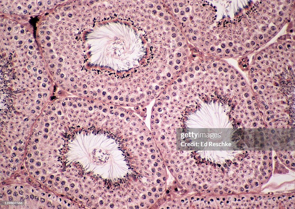 SEMINIFEROUS TUBULES, TESTIS, SPERMATOGENESIS, 50X. Shows: seminiferous tubules, spermatogenesis, lumen, spermatozoa, and interstitial cells (cells of Leydig).