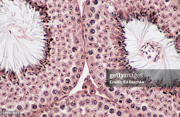 seminiferous tubules, testis, spermatogenesis, 100x.  shows:  seminiferous tubules, spermatogenesis, spermatozoa, lumen and interstitial cells (cells of leydig). - cellula di leydig foto e immagini stock