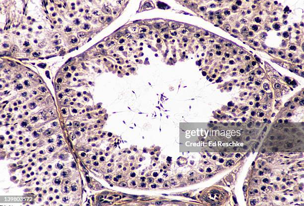 seminiferous tubule, testis, spermatogenesis, interstitial cells, 100x.  shows: spermatogenesis, spermatogonia, spermatocytes, spermatozoa, and interstitial cells (cells of leydig). - cellula di leydig foto e immagini stock