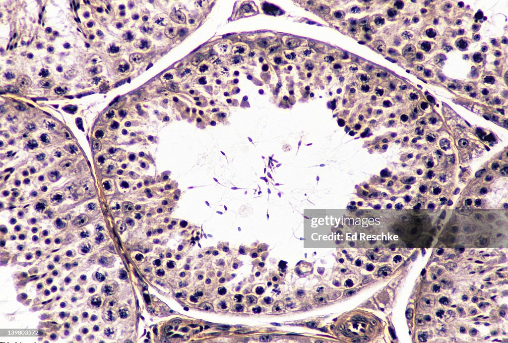SEMINIFEROUS TUBULE, TESTIS, SPERMATOGENESIS, INTERSTITIAL CELLS, 100X. Shows: spermatogenesis, spermatogonia, spermatocytes, spermatozoa, and interstitial cells (cells of Leydig).