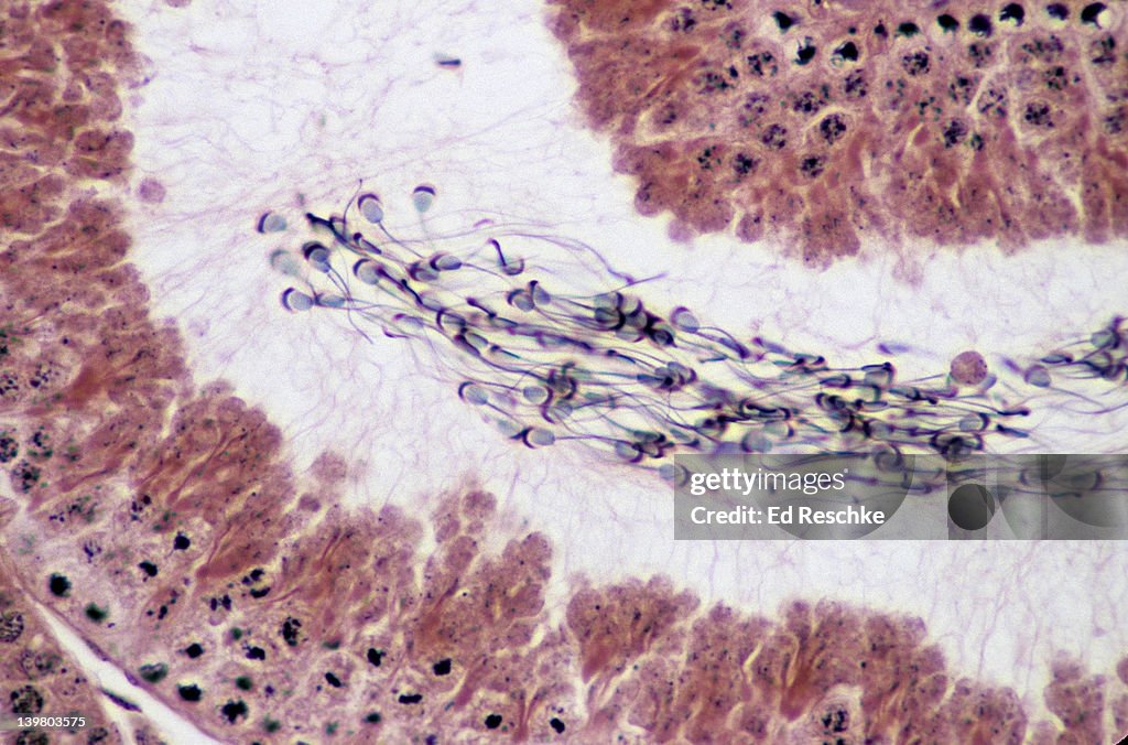 SPERMATOZOA IN A SEMINIFEROUS TUBULE, 100X. Spermatozoa show a: head, flagellum, and acrosome (secretes enzymes that help penetrate the egg), Guinea pig.