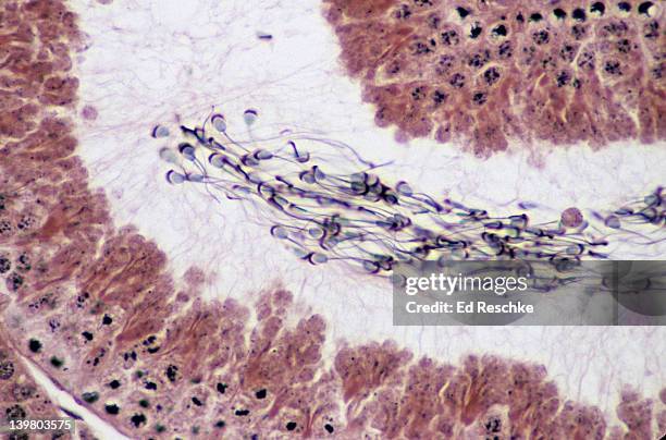 spermatozoa in a seminiferous tubule, 100x.  spermatozoa show a: head, flagellum, and acrosome (secretes enzymes that help penetrate the egg), guinea pig. - genomborra bildbanksfoton och bilder