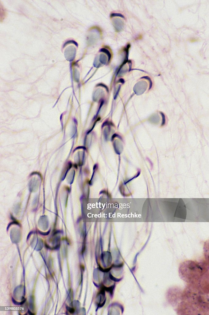 SPERMATOZOA WITH ACROSOMES, 250X.  The spermatozoa show a:  head, flagellum and acrosome (secretes enzymes that help penetrate the egg).  Spermatozoa are in a seminiferous tubule.  Guinea pig.