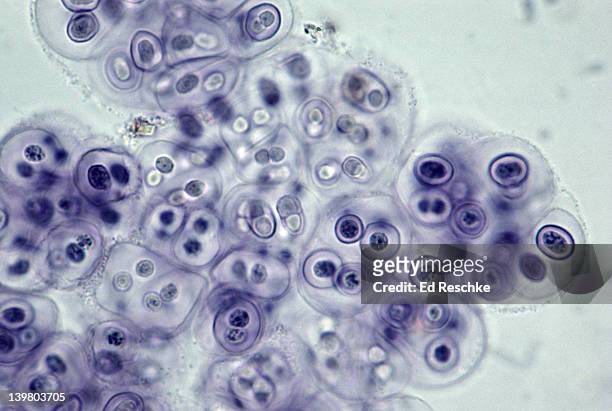 gloeocapsa. blue green algae, cyanobacteria. nitrogen fixing, unicellular algae cells enclosed in layers. 250x at 35mm.  - microbio foto e immagini stock