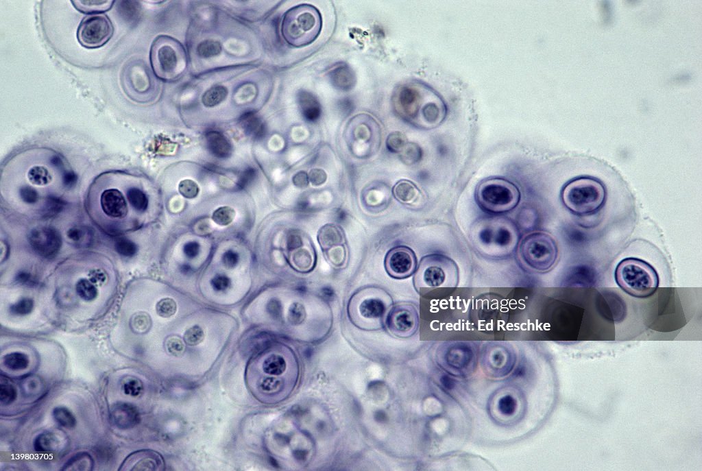 GLOEOCAPSA. BLUE GREEN ALGAE, CYANOBACTERIA. NITROGEN FIXING, UNICELLULAR ALGAE CELLS ENCLOSED IN LAYERS. 250X at 35mm.